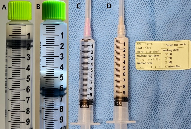 그림1. 필자의 줄기세포 부피와 현탁액의 혼탁도 비교.A: 1억개 세포 원심분리 후 용량 1.2cc. B: 1억 8백만개 세포 원심분리 후 용량 1.25cc. C:세포가 없는 비교용 주사기. D; 1억 8백만개를 10cc에 현탁한 상태의 혼탁도.
