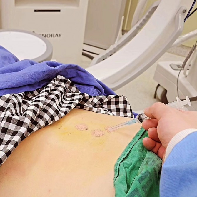 방송인 노홍철이 건강이 걱정되는 사진을 공개했다. 노홍철은 지팡이를 짚은 채 휠체어를 탄 사진과 함께 병원에서 허리에 주사를 맞는 사진도 게재했다. 사진=노홍철 인스타그램