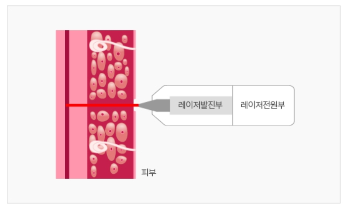 빈이미지