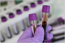 美 FDA, 로슈·일라이 릴리 '알츠하이머 혈액검사 혁신 기기' 인정
