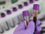 美 FDA, 로슈·일라이 릴리 '알츠하이머 혈액검사 혁신 기기' 인정